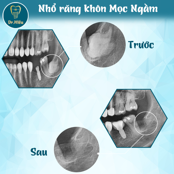 Hình ảnh phòng điều trị tiêu chuẩn tại Nha Khoa BS.Hiếu