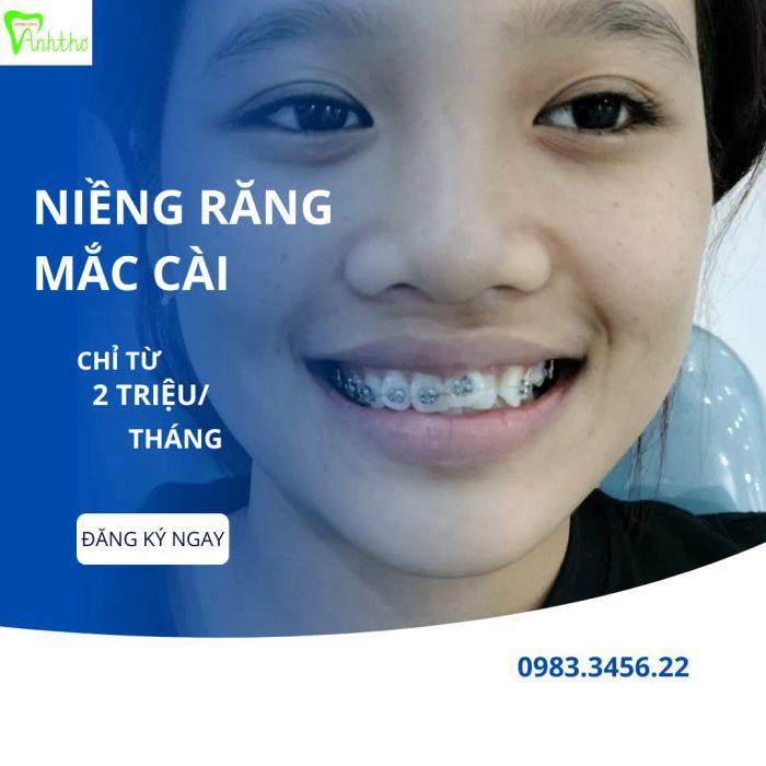 Hệ thống trang thiết bị tiên tiến tại Nha Khoa Anh Thơ