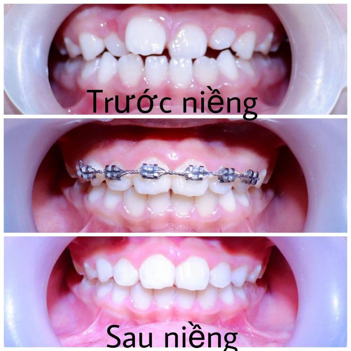 Không gian điều trị cao cấp tại Nha Khoa Việt Pháp Cần Thơ