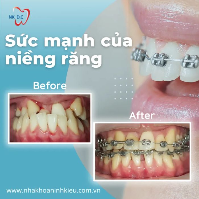 Hệ thống trang thiết bị tiên tiến tại Nha Khoa Ninh Kiều