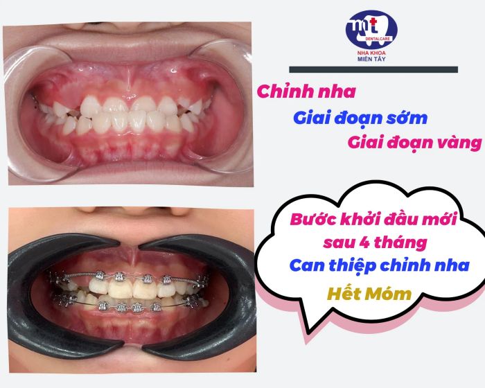 Hình ảnh thực tế Nha Khoa Miền Tây