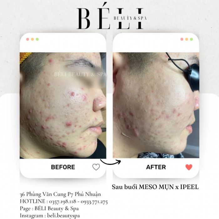 BÉLI Beauty & Spa ảnh 1