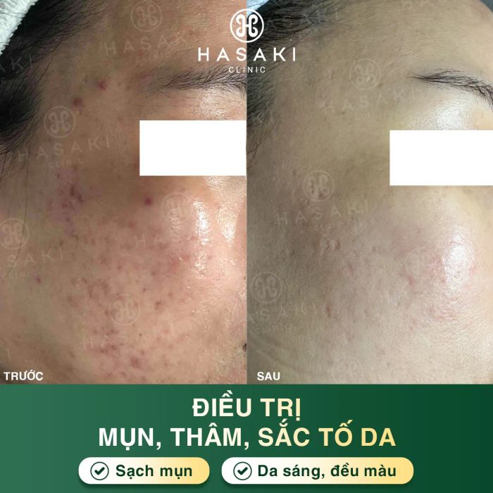 Hasaki Clinic & Spa ảnh 1
