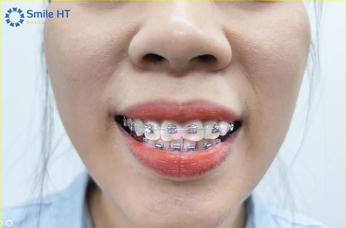 Không gian hiện đại và sang trọng tại Nha Khoa Thẩm Mỹ Smile HT