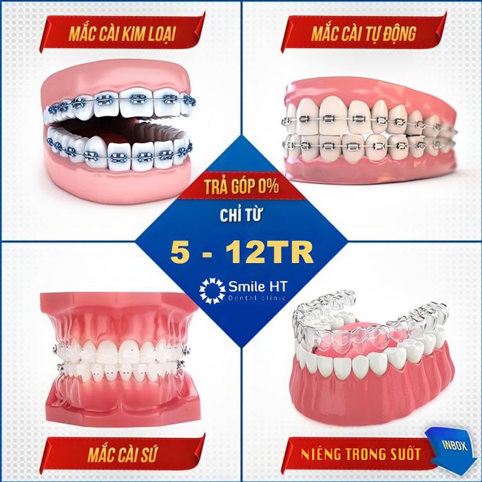 Hình ảnh phòng khám hiện đại tại Nha Khoa Thẩm Mỹ Smile HT