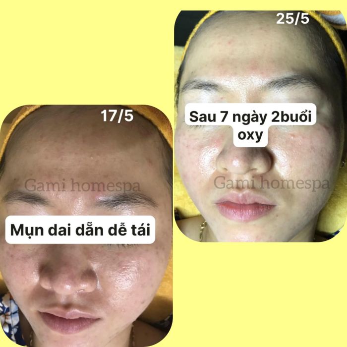 Thư viện hình ảnh trị liệu thực tế tại Gami Homespa