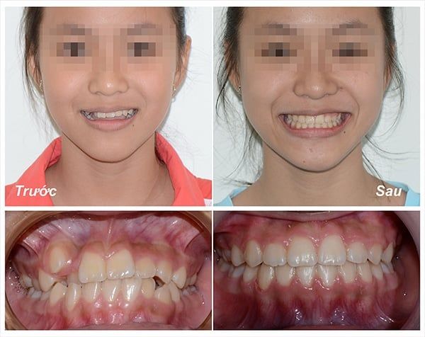 Hình ảnh không gian hiện đại tại Nha Khoa ADEN