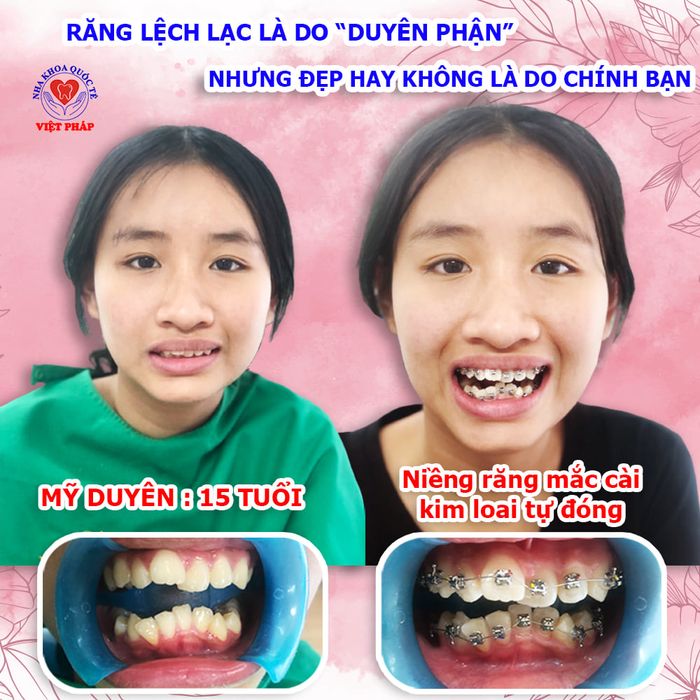 Hệ thống trang thiết bị tân tiến tại Nha Khoa Quốc Tế Việt Pháp