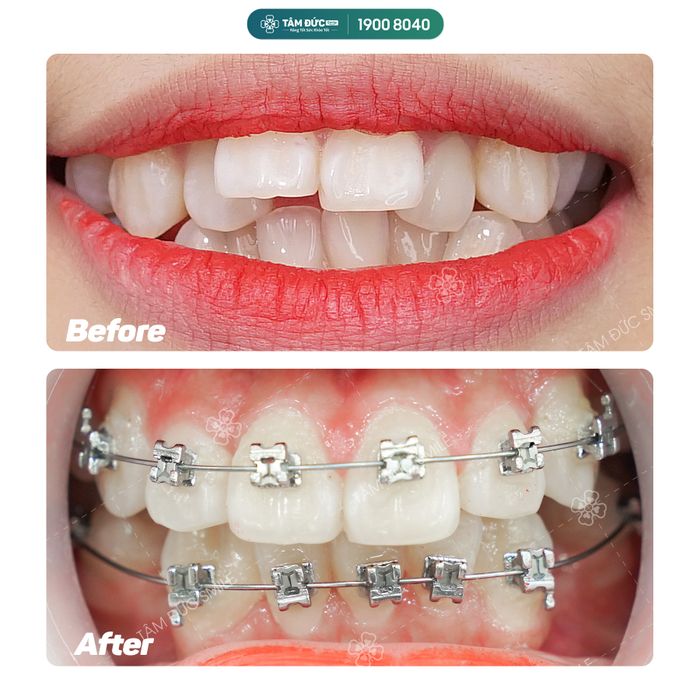 Hệ thống trang thiết bị tiên tiến tại Nha Khoa Tâm Đức Smile