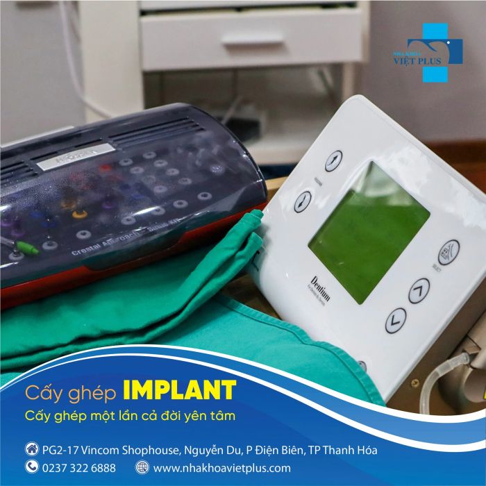 Nha Khoa Việt Plus - Địa chỉ uy tín cho dịch vụ trồng răng Implant chất lượng cao