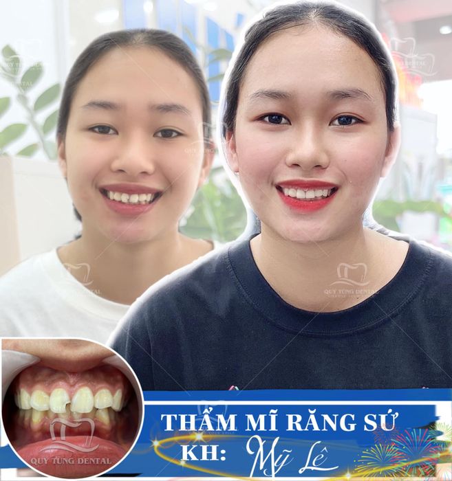Hình ảnh phòng khám hiện đại tại Nha Khoa Quý Tùng Thái Nguyên