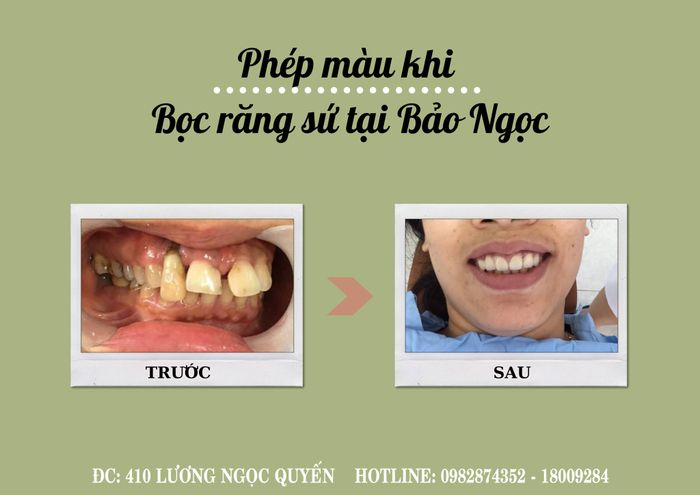 Hình ảnh đội ngũ bác sĩ chuyên môn tại Nha Khoa Bảo Ngọc
