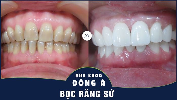 Hình ảnh phòng khám tiêu chuẩn 5 sao tại Nha Khoa Đông Á