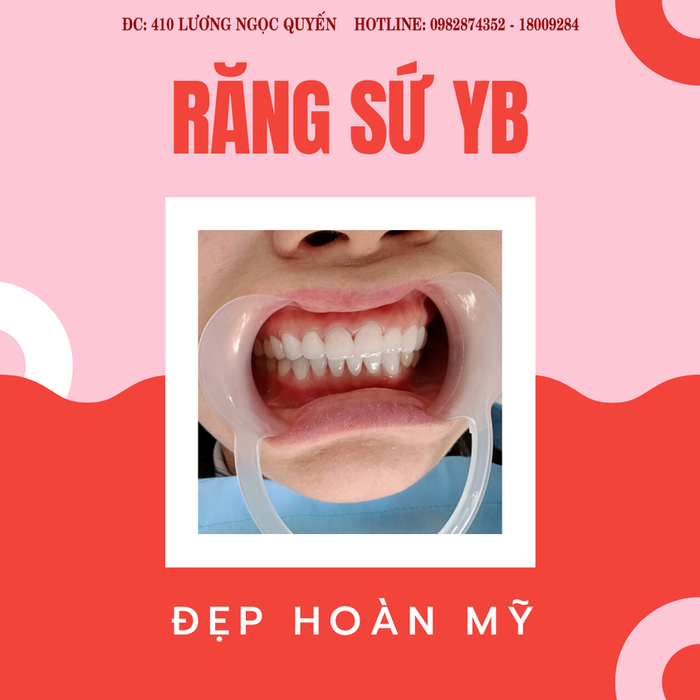 Hình ảnh hệ thống phòng khám đạt chuẩn tại Nha Khoa Bảo Ngọc