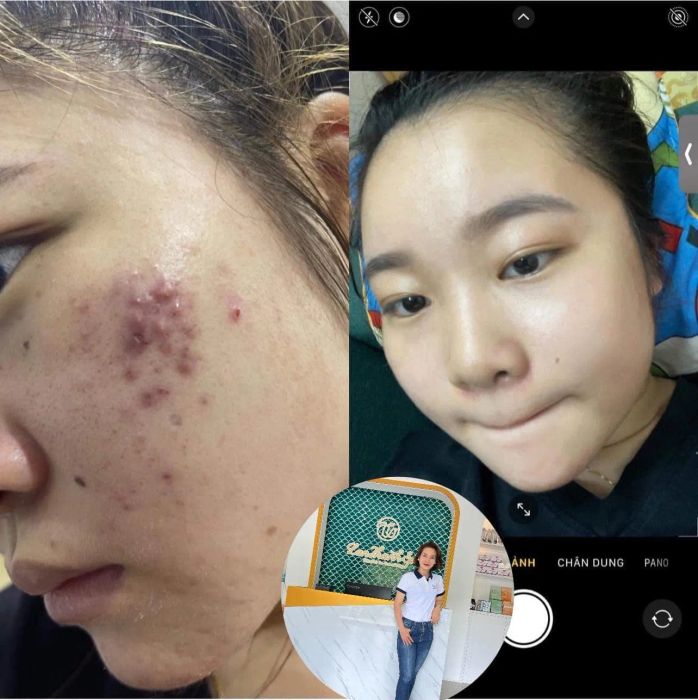 Hình ảnh khu vực điều trị chuyên nghiệp tại Lan Thanh Spa