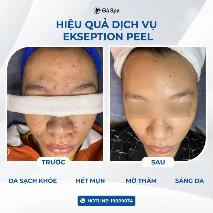 Không gian điều trị hiện đại tại Gà Spa Bình Dương