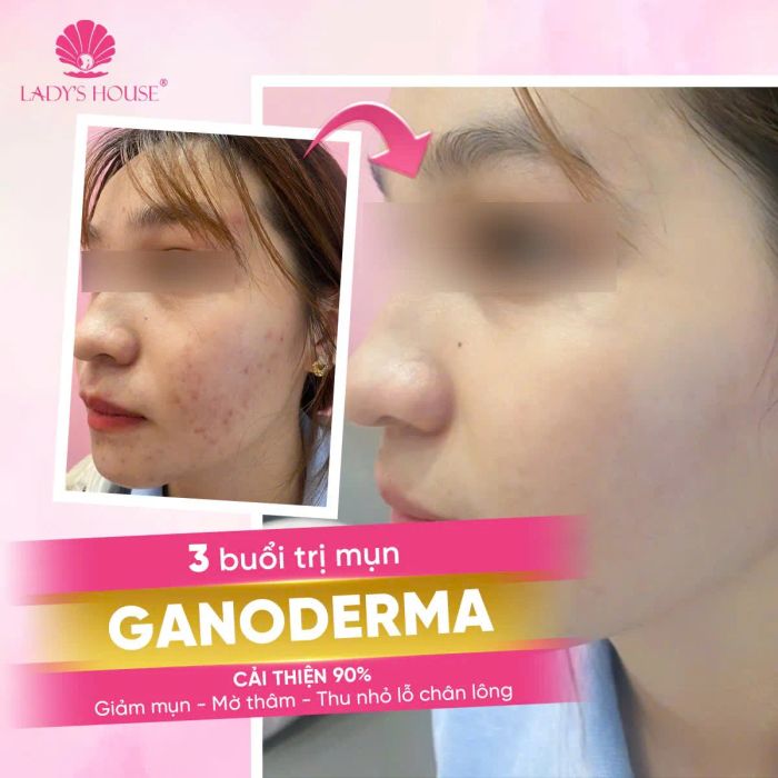 Hình ảnh không gian điều trị tại Lady's House Spa & Clinic