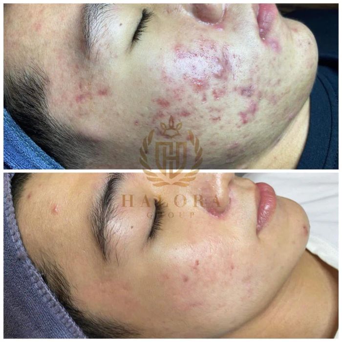Hình ảnh thực tế tại Viện Thẩm Mỹ Vân Nguyễn - Học Viện Thẩm Mỹ Halora