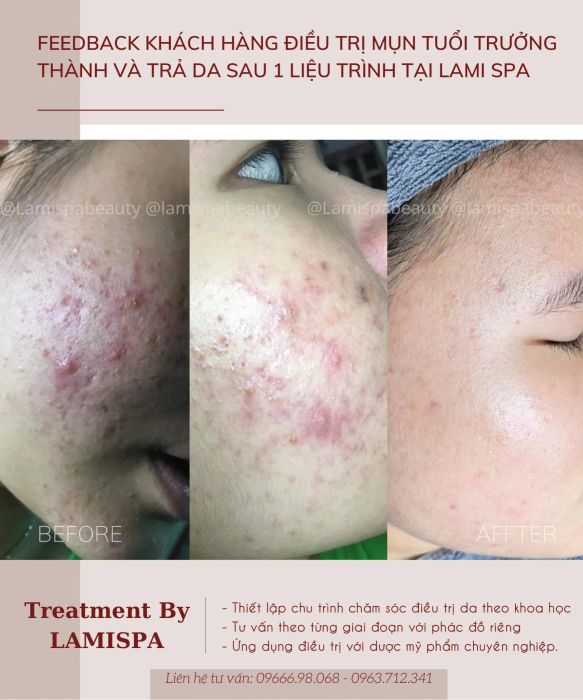 Không gian điều trị chuẩn y khoa tại Lami Spa - Beauty & Academy