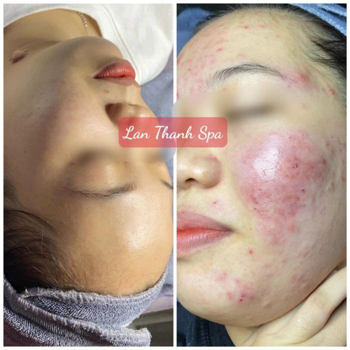 Không gian sang trọng và thư giãn tại Lan Thanh Spa