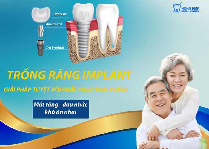 Hình ảnh nổi bật tại Nha khoa Hồng Điệp – Ảnh 1