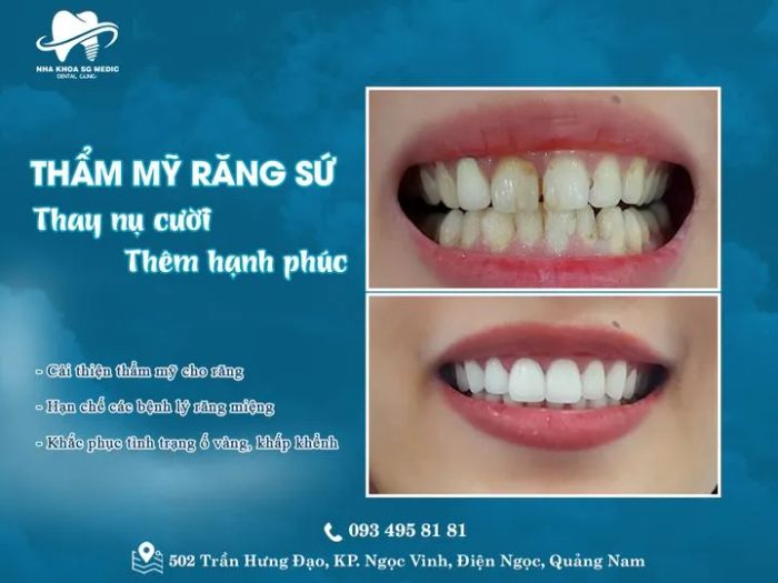 Ảnh minh họa Nha Khoa Sài Gòn Medic 2