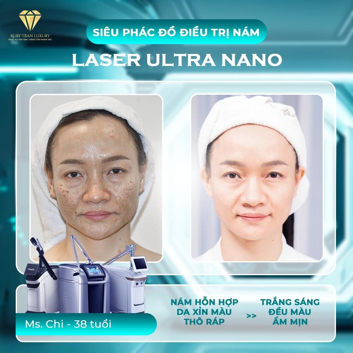 Ruby Tran Spa ảnh 1 - Hình ảnh thực tế về không gian sang trọng và hệ thống máy móc công nghệ cao