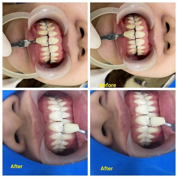 Hệ thống trang thiết bị hiện đại tại Nha Khoa Tâm Đức