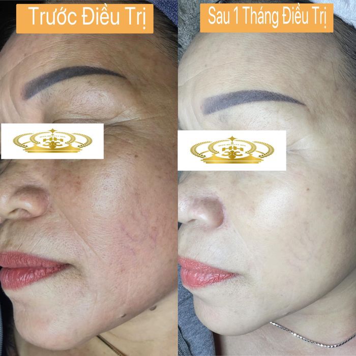 Hình ảnh không gian chăm sóc cao cấp tại Miss Beauty Spa