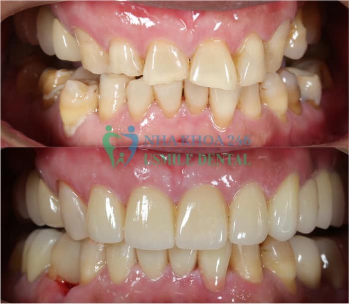 Nha khoa 246 - Usmile Dental hình ảnh 2