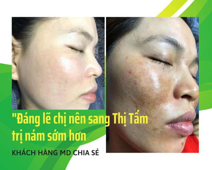 Hình ảnh quy trình chăm sóc da chuyên nghiệp tại Thị Tấm