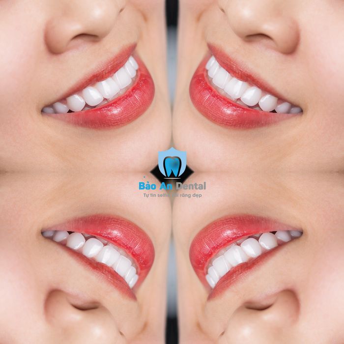 Nha khoa Bảo An Dental - Hình ảnh 1