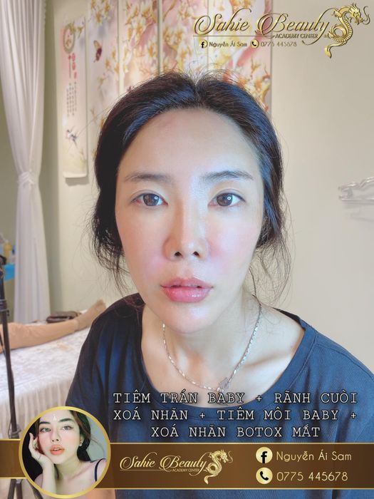 Khám phá những hình ảnh thực tế về quy trình làm đẹp chuyên nghiệp tại SAHIE Beauty