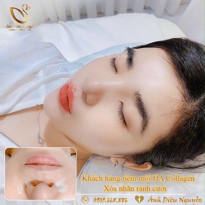 Hình ảnh Thẩm Mỹ Viện Ánh Diệu Nguyễn