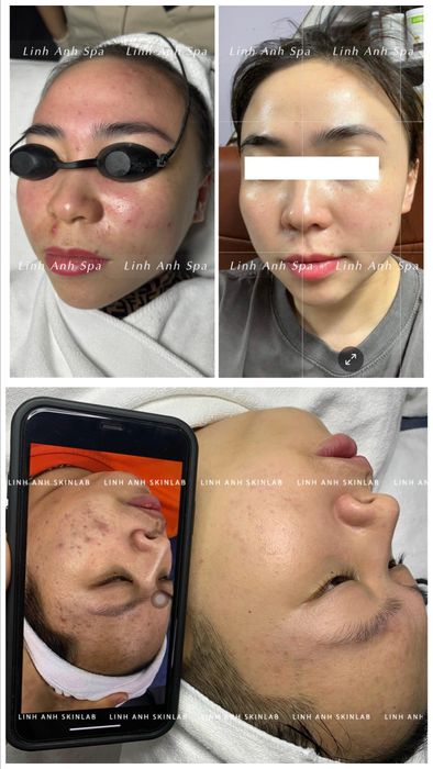 Hình ảnh thực tế không gian sang trọng tại Linh Anh Skinlab
