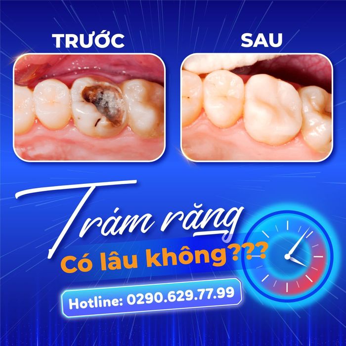 Hình ảnh thực tế Nha Khoa HOÀN MỸ SÀI GÒN - Chi nhánh Cái Nước