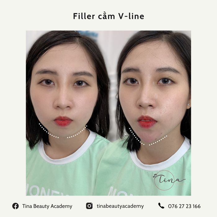 Hình ảnh thực tế về kết quả làm đẹp ấn tượng tại Tina Beauty Academy