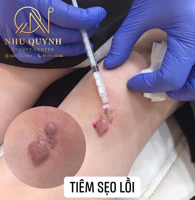 Hình ảnh thực tế về không gian sang trọng tại Như Quỳnh Beauty Center