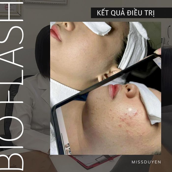 Miss Duyên Beauty ảnh 1 - Không gian ấm cúng và quy trình chăm sóc da chuyên nghiệp