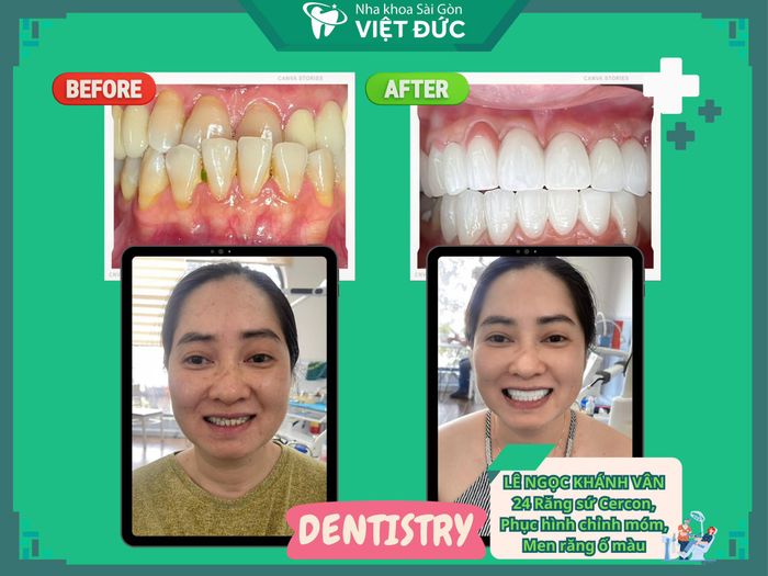 Nha Khoa Sài Gòn Quốc Tế Việt Đức (Hình ảnh 2)