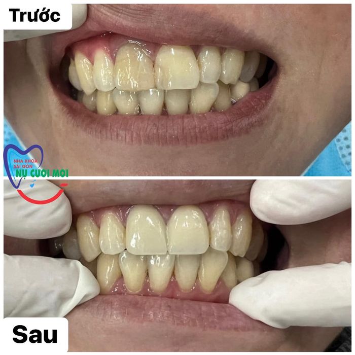 Nha khoa Sài Gòn Nụ Cười Mới ảnh 2