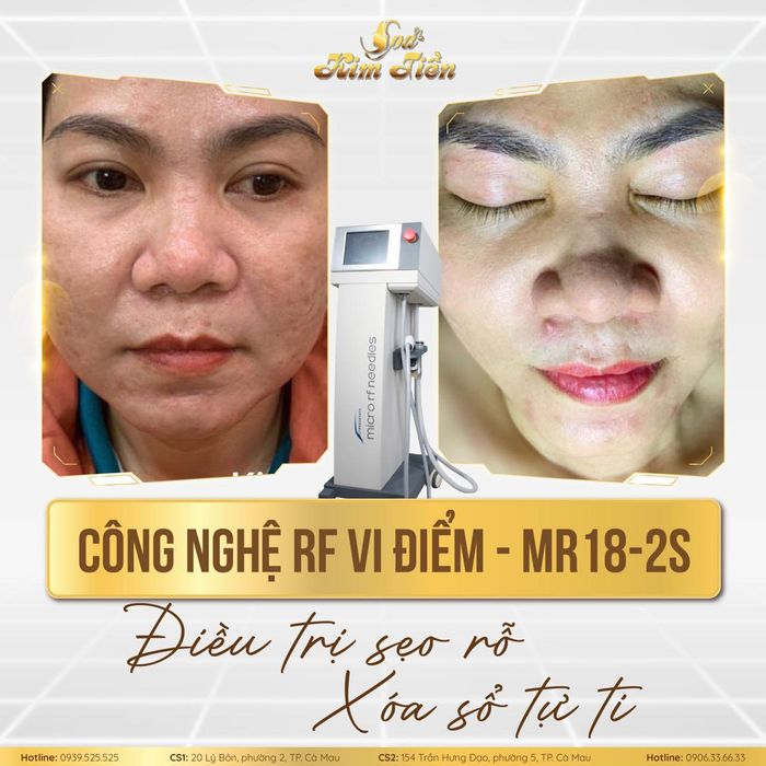 Không gian trị liệu chuyên nghiệp tại Spa Kim Tiền