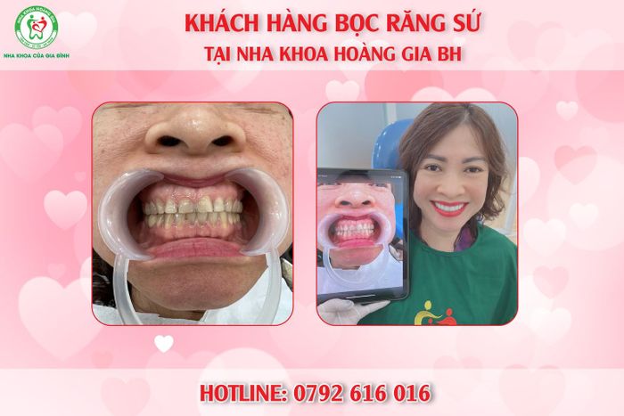 Nha Khoa Hoàng Gia Biên Hòa ảnh 2