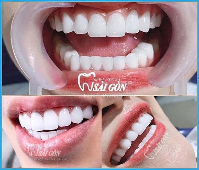 Hệ thống máy móc tân tiến tại Nha Khoa Sài Gòn
