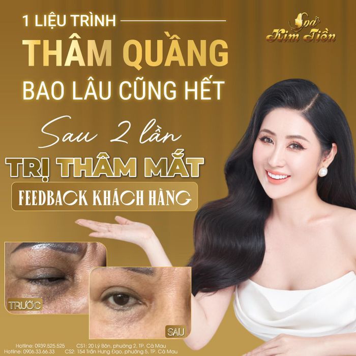 Quy trình điều trị da chuẩn y khoa tại Spa Kim Tiền