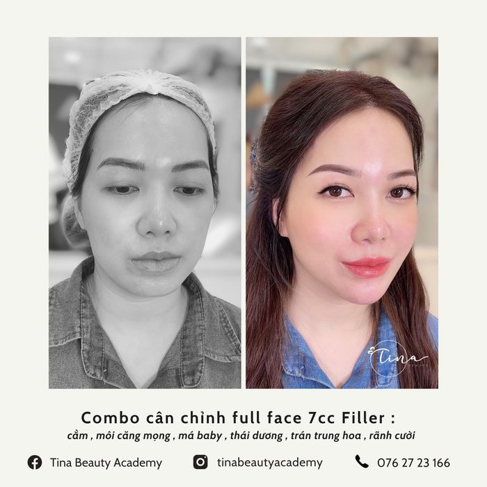 Khám phá không gian sang trọng và quy trình làm đẹp chuyên nghiệp tại Tina Beauty Academy qua những hình ảnh ấn tượng