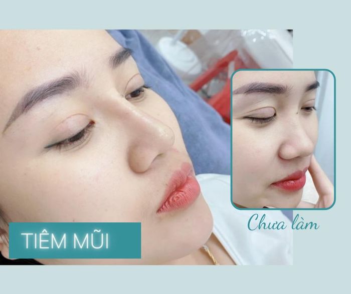 Hình ảnh thực tế về dịch vụ tại Thảo Ngọc Beauty
