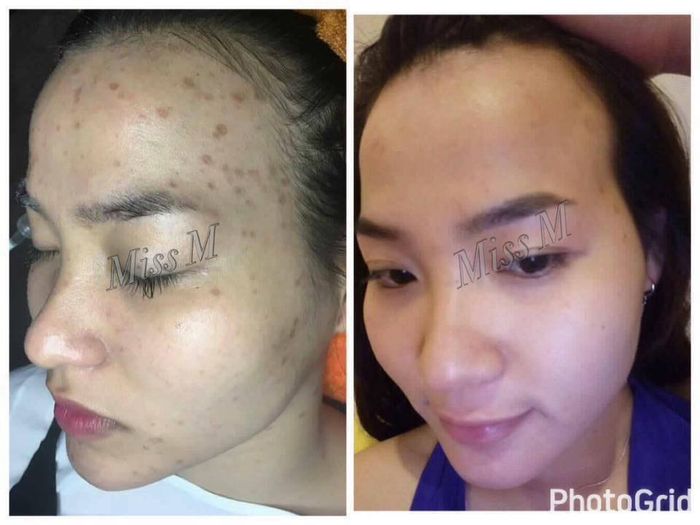 Miss M Spa ảnh 2