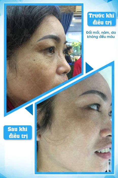 Phòng điều trị tiêu chuẩn tại Taza Skin Clinic