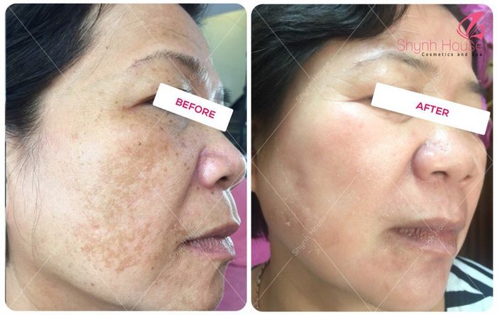 Không gian sang trọng tại Shynh Beauty Spa